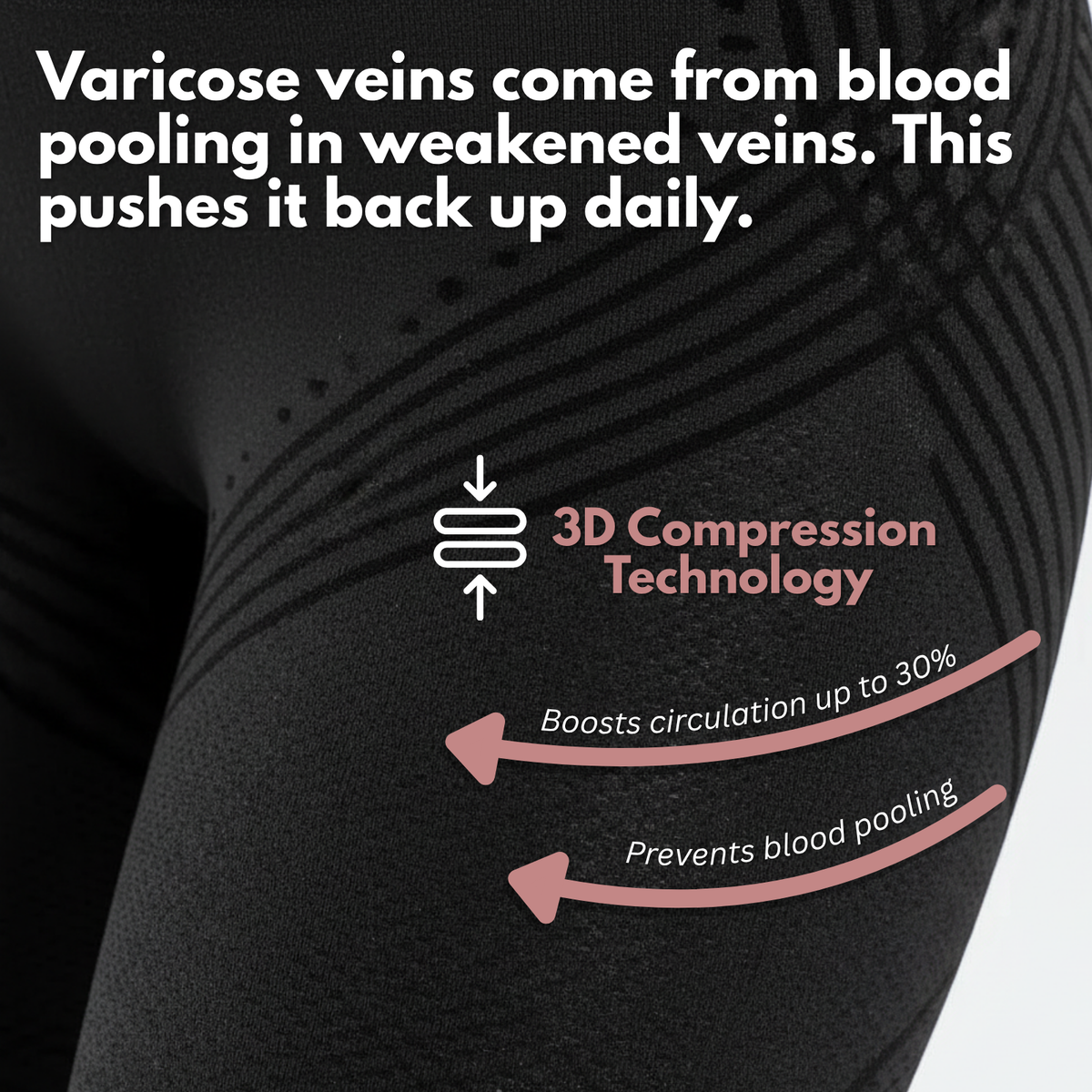 VARICOSE VEINS