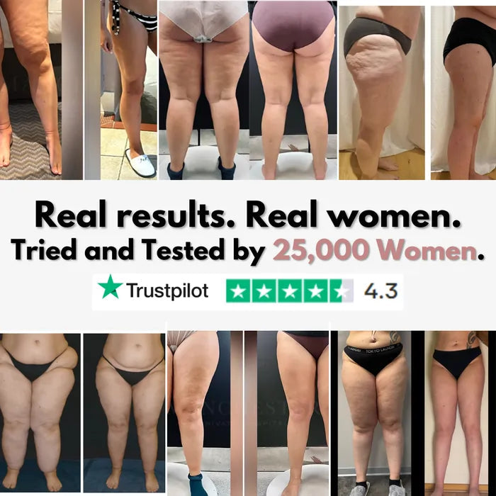 Cellumove 3D Legging – Say goodbye to lipoedema pain and swelling naturally Cellumove