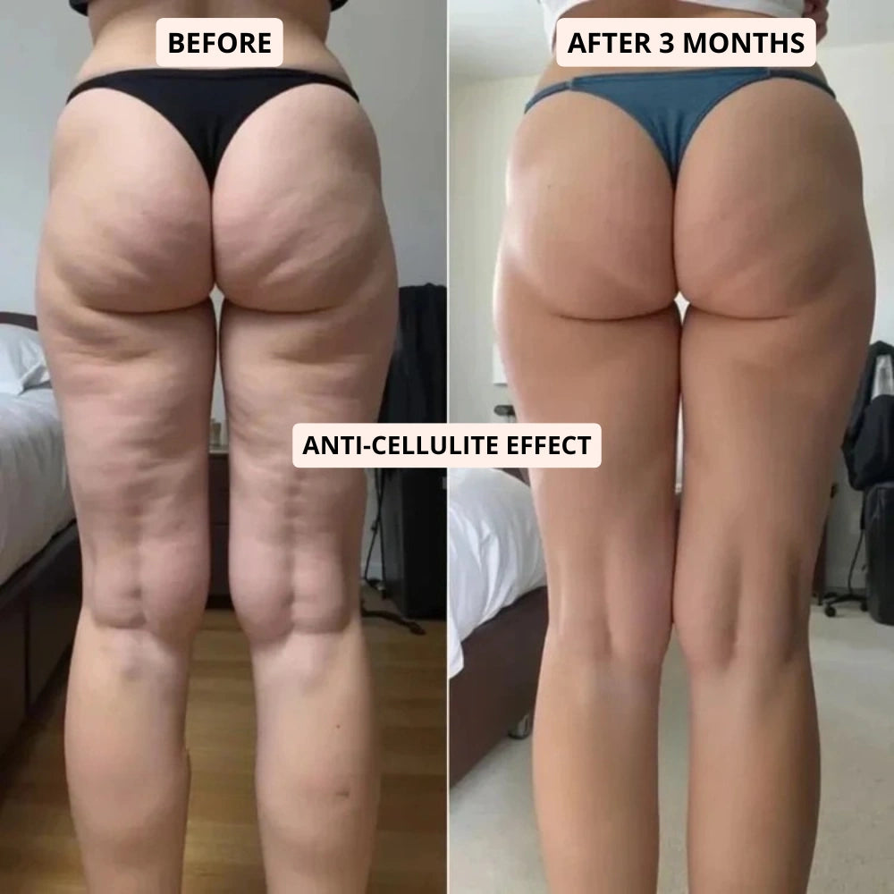 CELLUMOVE™ || 3D Metabolic Booster Leggings Cellumove