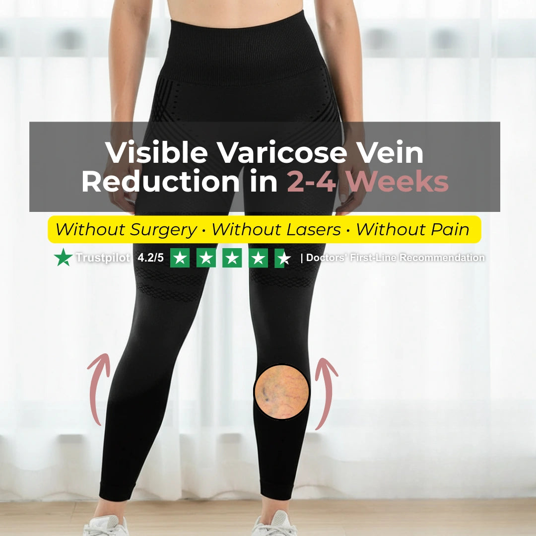 Visible Vein Relief in Just 14 Days with Cellumove 3D Compression Leggings
