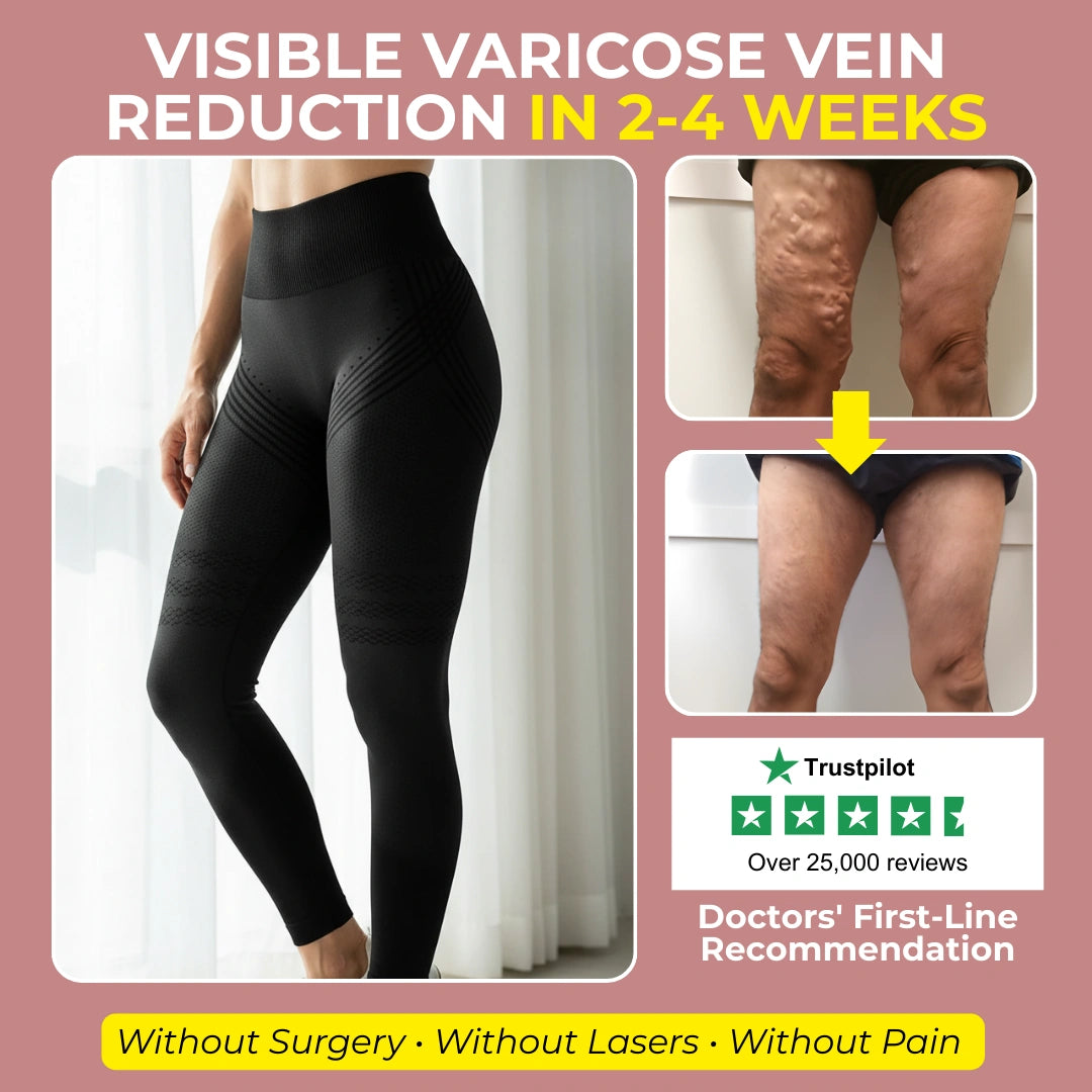Visible Vein Relief in Just 14 Days with Cellumove 3D Compression Leggings