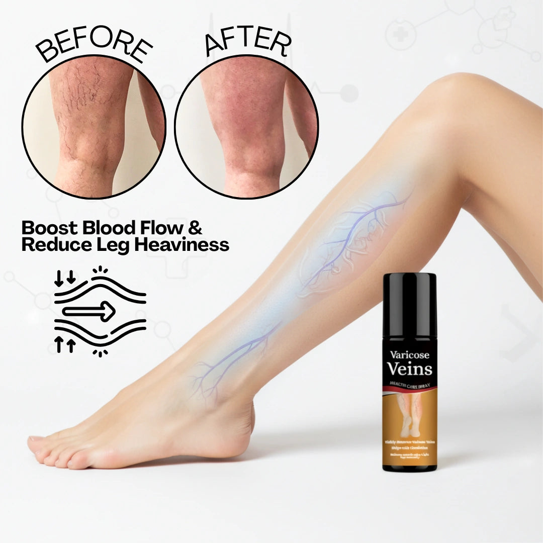 Varicose Vein Spray Leg Pain Gone, Confidence On