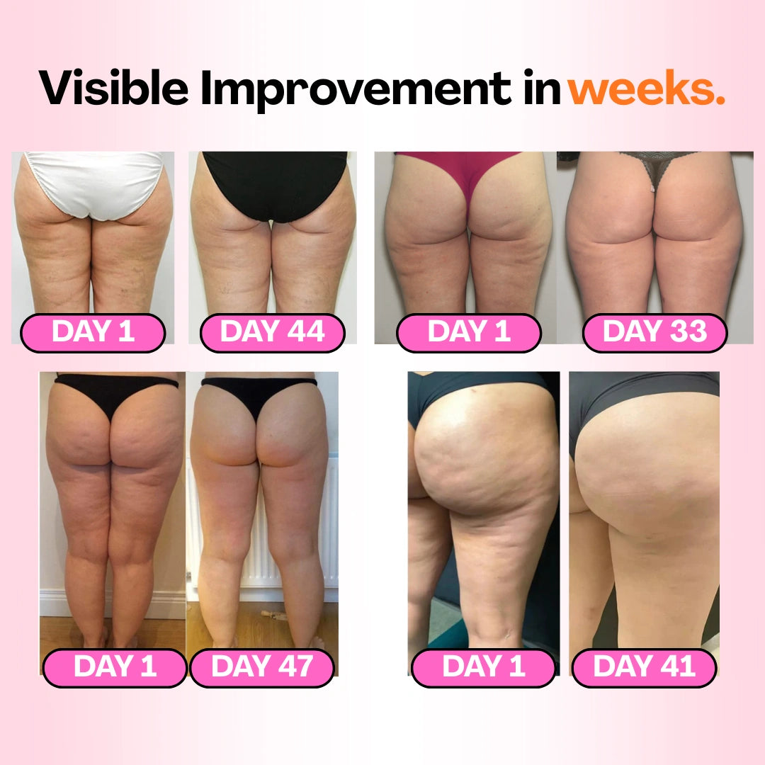 Anti-cellulite Tights -  Redefine your silhouette effortlessly (3-Pack) Cellumove