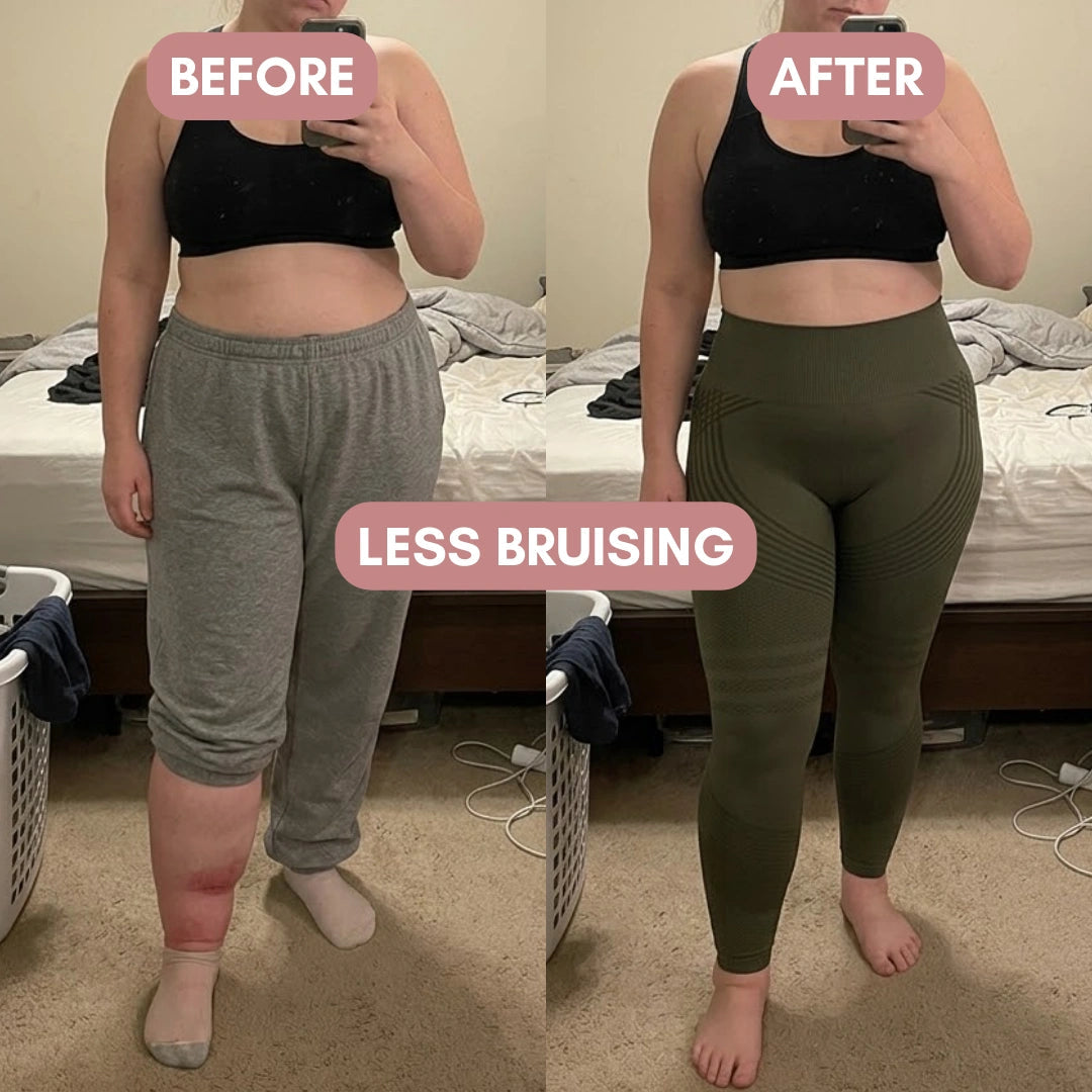 Cellumove 3D Legging – For Legs That Felt Like Anvils Cellumove