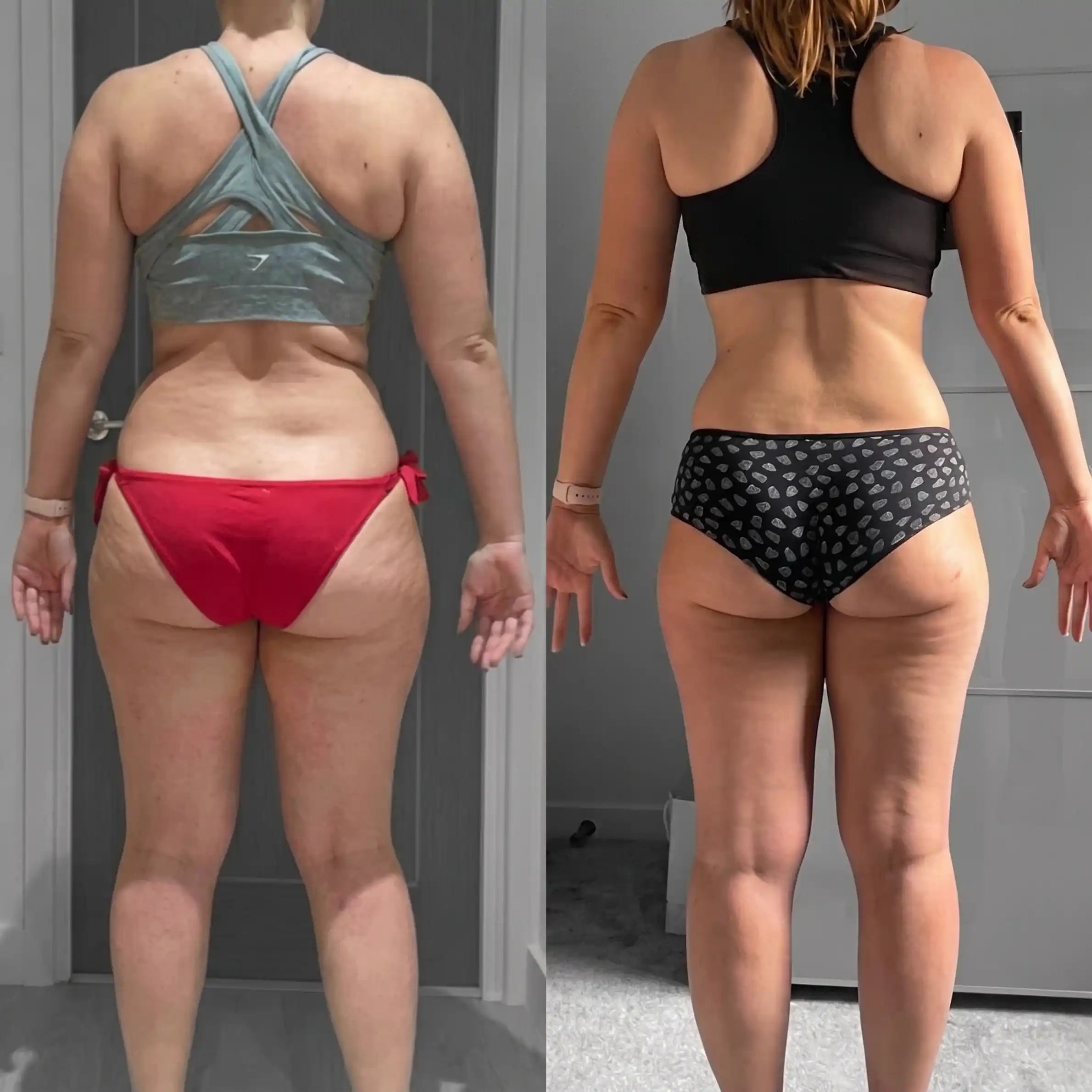 Cellumove 3D short - Redefine your silhouette effortlessly