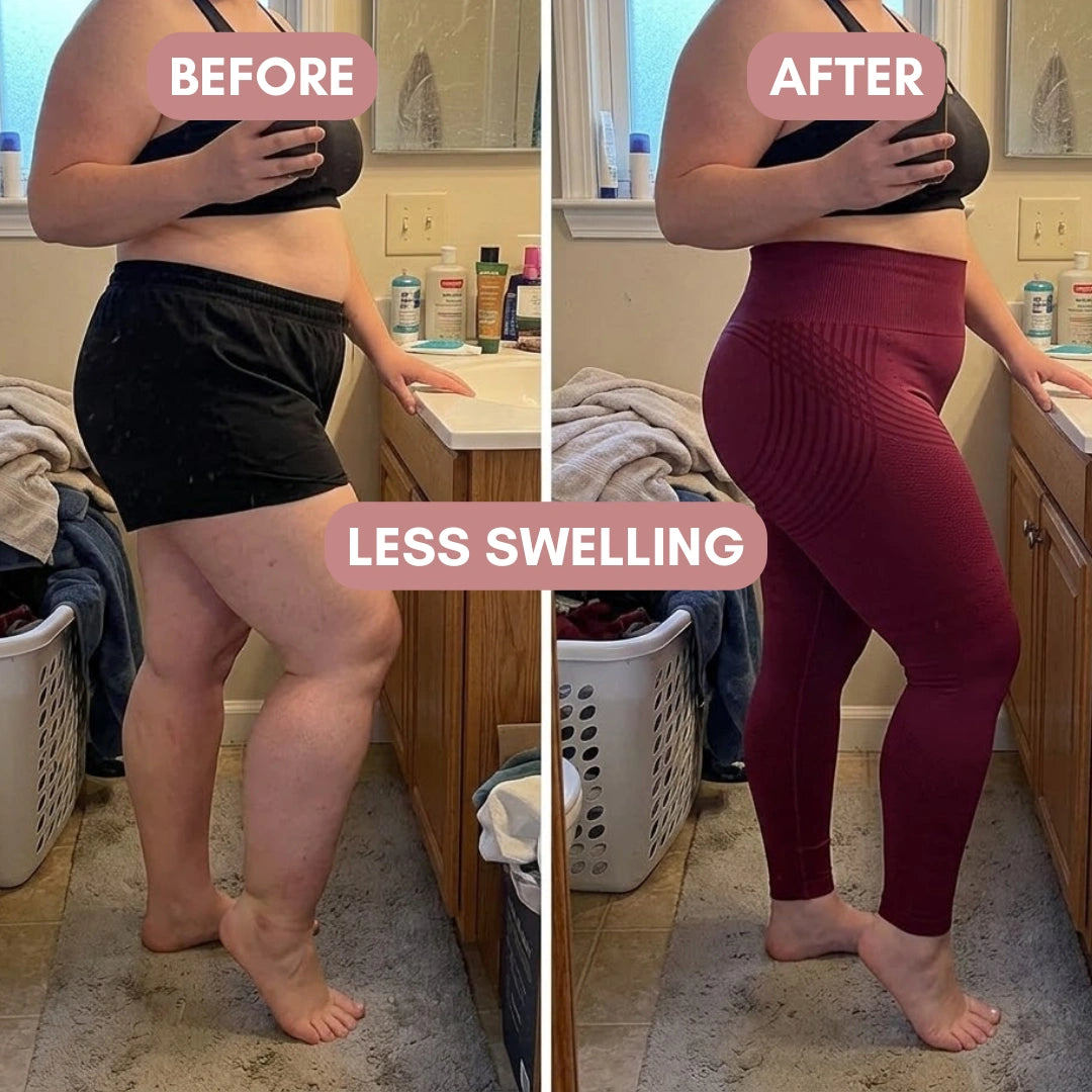 Cellumove 3D Legging – For Legs That Felt Like Anvils Cellumove