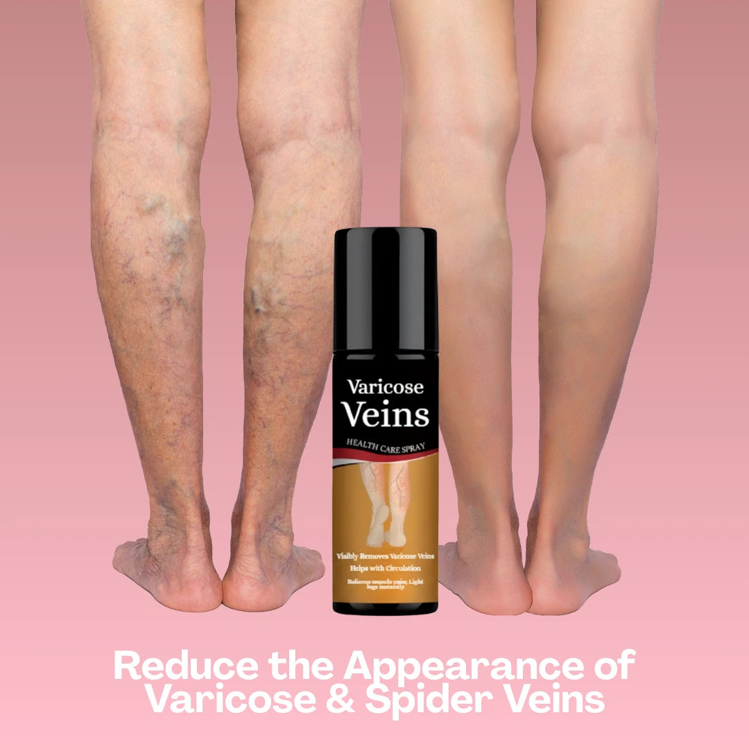 Varicose Vein Spray Leg Pain Gone, Confidence On Cellumove