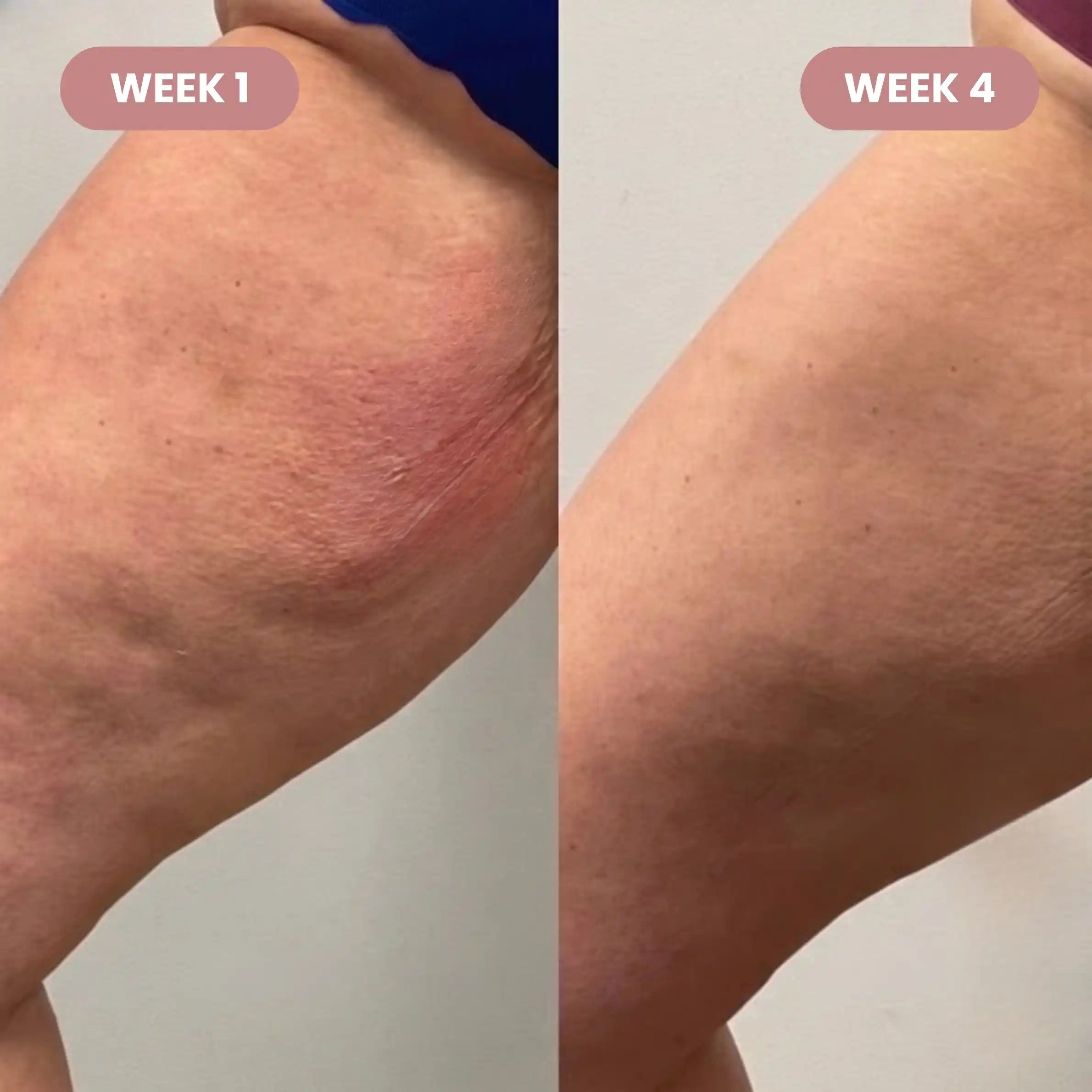 Cellumove 3D short - Redefine your silhouette effortlessly