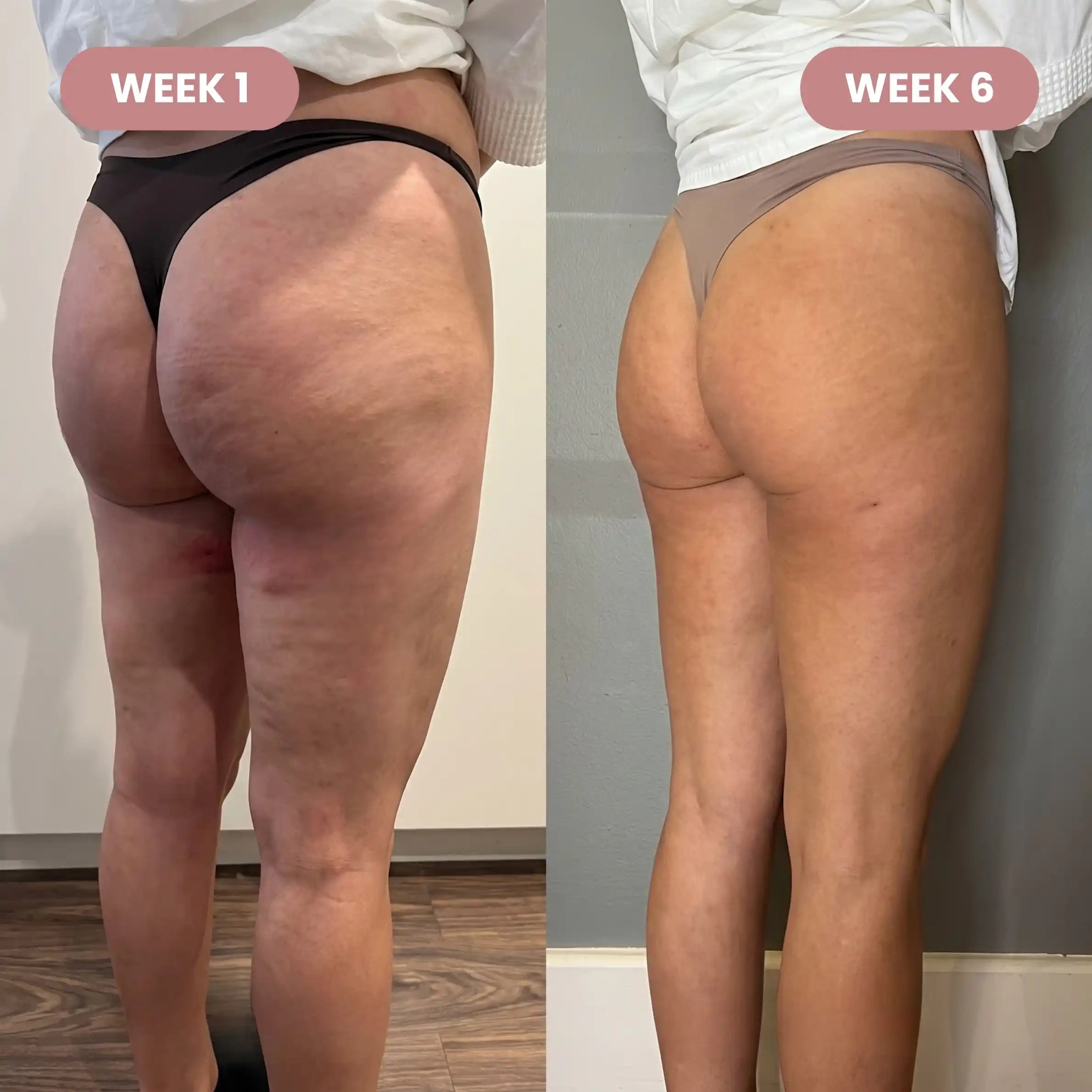 Cellumove 3D short - Redefine your silhouette effortlessly