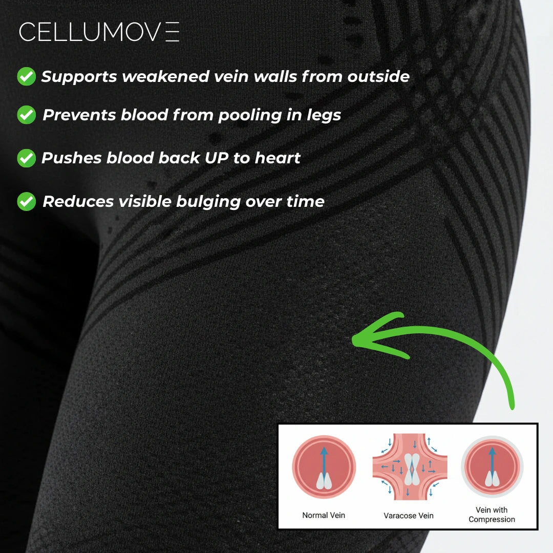 Visible Vein Relief in Just 14 Days with Cellumove 3D Compression Leggings Cellumove