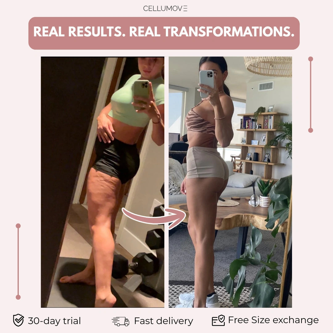 The anti-cellulite legging for women who've tried everything — visible results in 14 days Cellumove