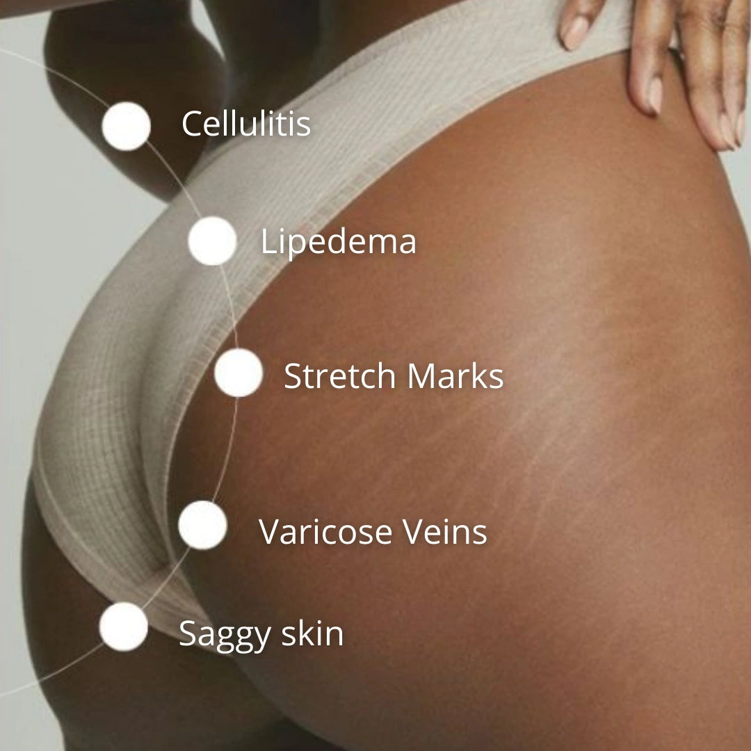 Cellumove Multifunctional Cream 300g Cellumove