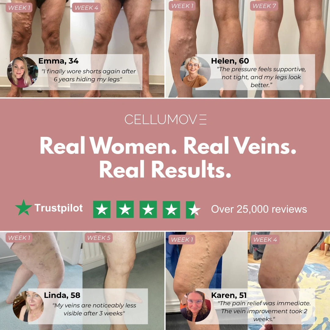 Visible Vein Relief in Just 14 Days with Cellumove 3D Compression Leggings Cellumove