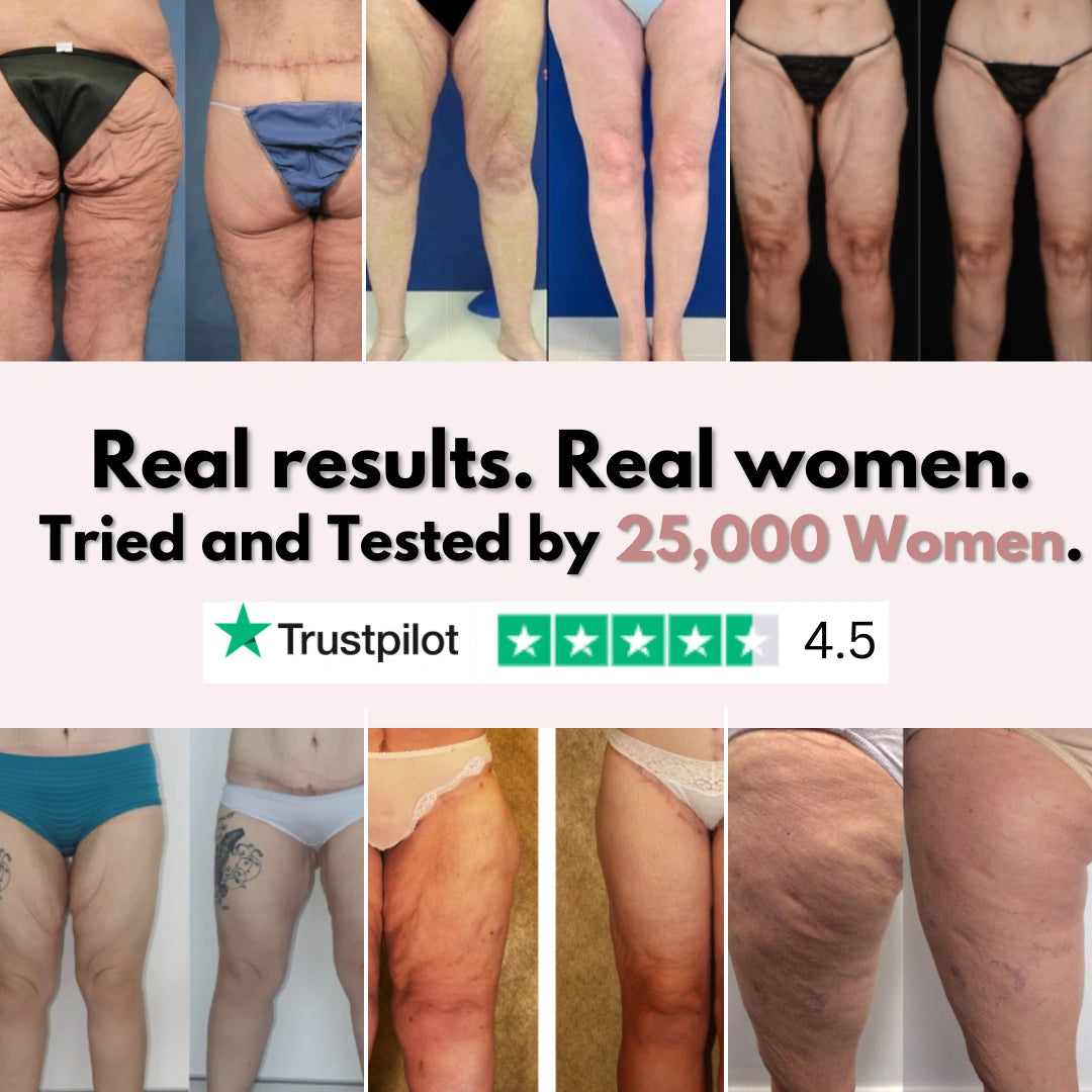 Firmer, smoother legs in 14 days — for women tired of saggy skin holding them back Cellumove
