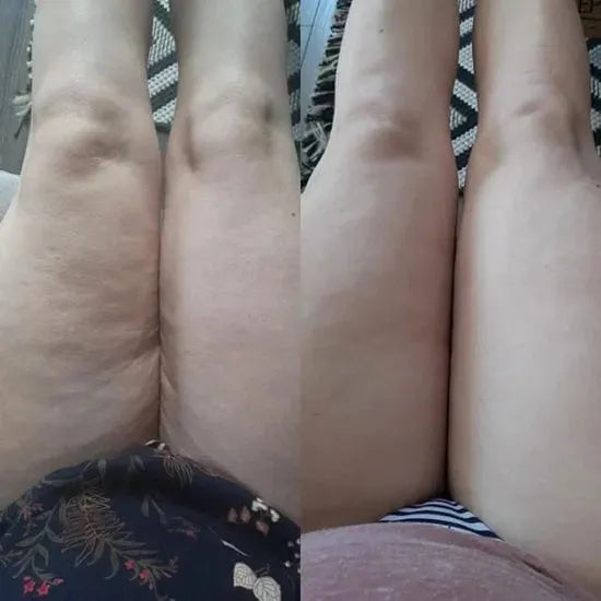Antes e depois – Paula