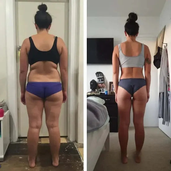 Cellumove 3D Legging Anti Cellulite - Kompressionsleggins Damen High Waist