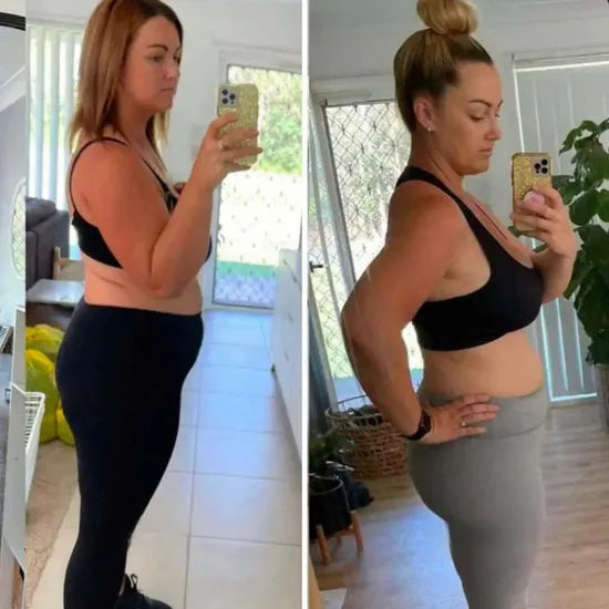 Antes e depois – Carla