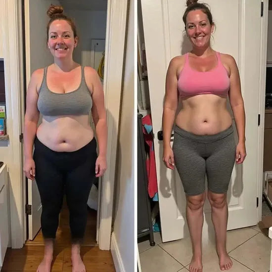 Antes e depois – Ana