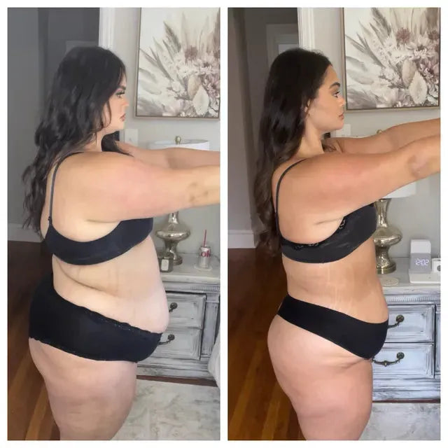 CelluMove customer using the GLP-1 patch