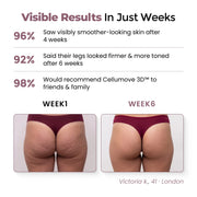 Cellumove 3D Legging – Redefine your silhouette effortlessly
