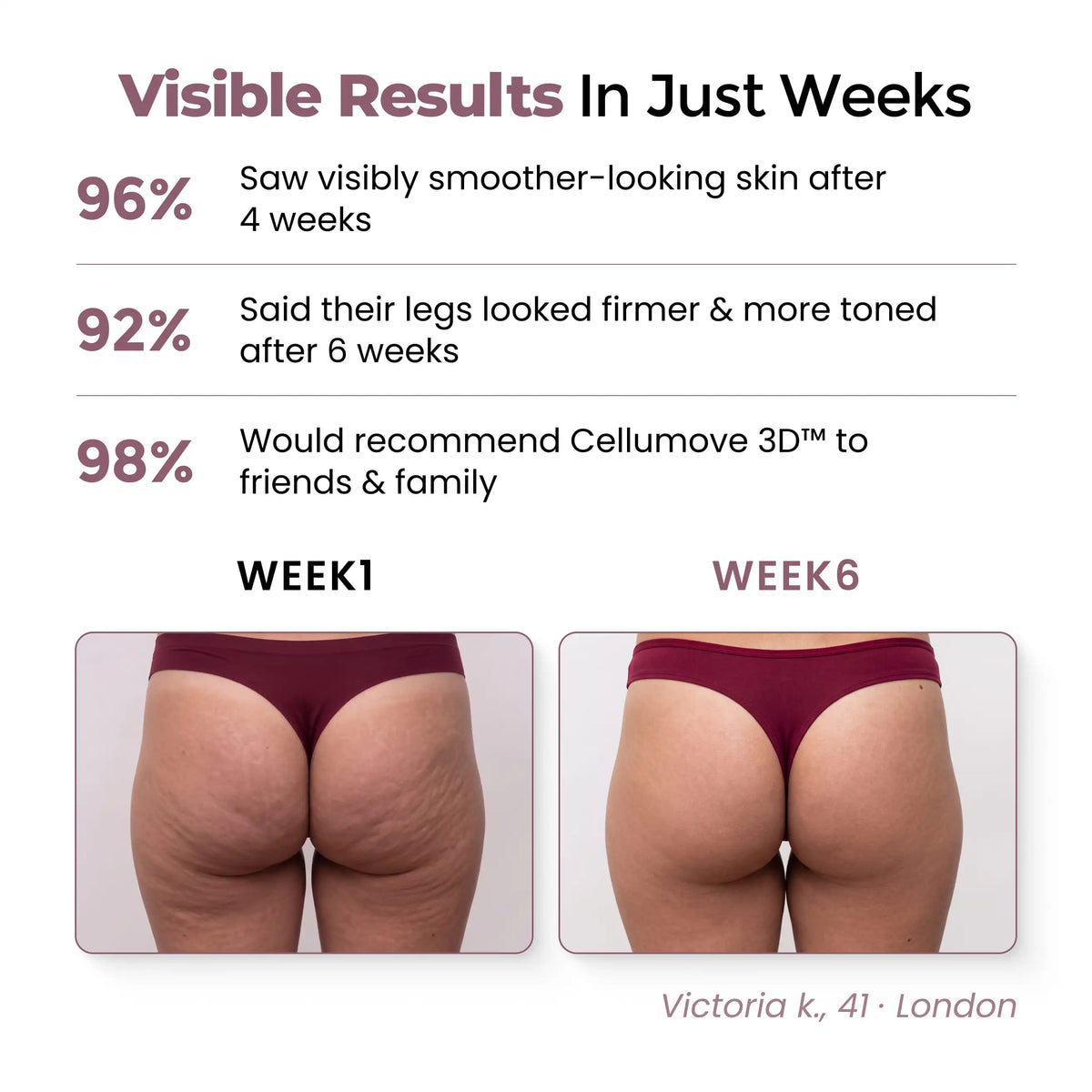 Cellumove 3D Legging – Redefine your silhouette effortlessly