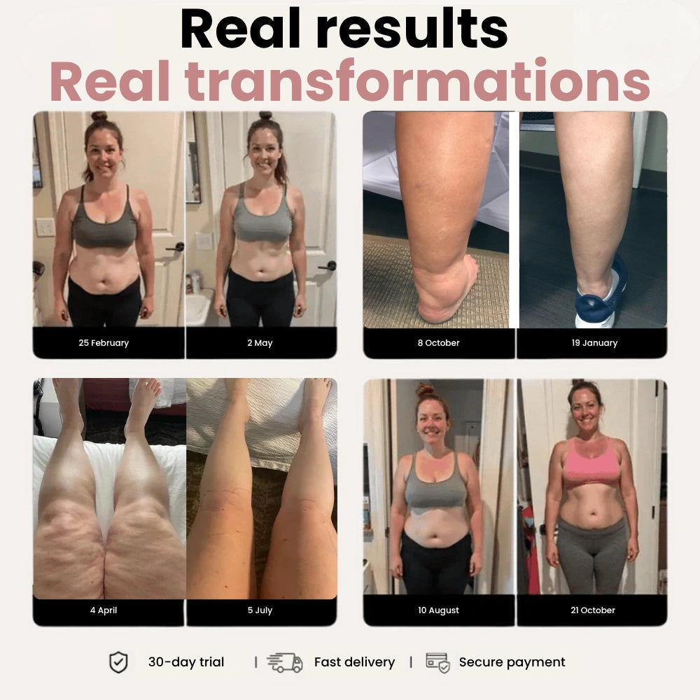 Cellumove 3D Legging – Designed to reduce post-partum swelling and restore comfort naturally. Cellumove