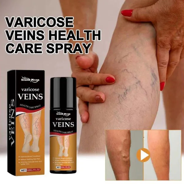 Varicose Vein Spray Leg Pain Gone, Confidence On